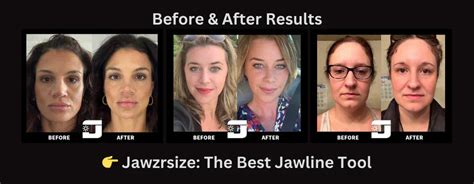 jawzrsize|jawzrsize before and after.